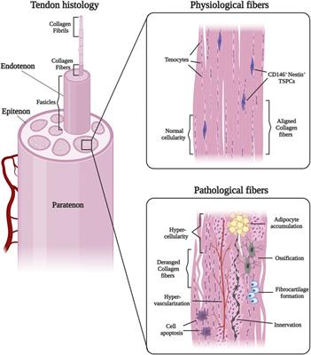 The roles and therapeutic potentialof mesenchymal stem/stromal cells and their extracellular vesicles in tendinopathies